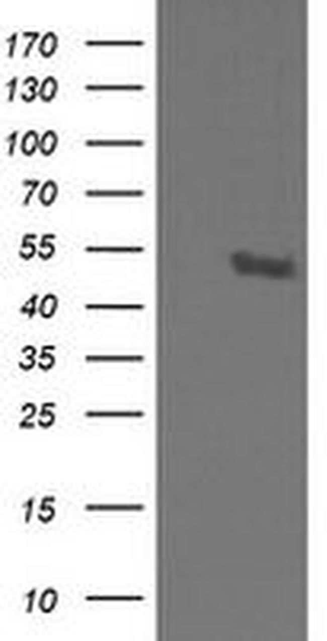 STK38L Antibody in Western Blot (WB)