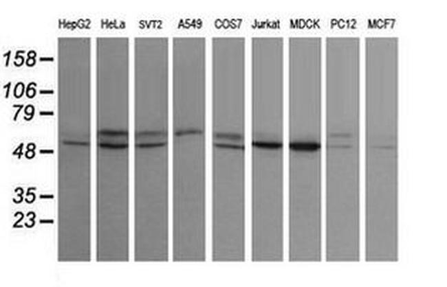 STK38L Antibody in Western Blot (WB)