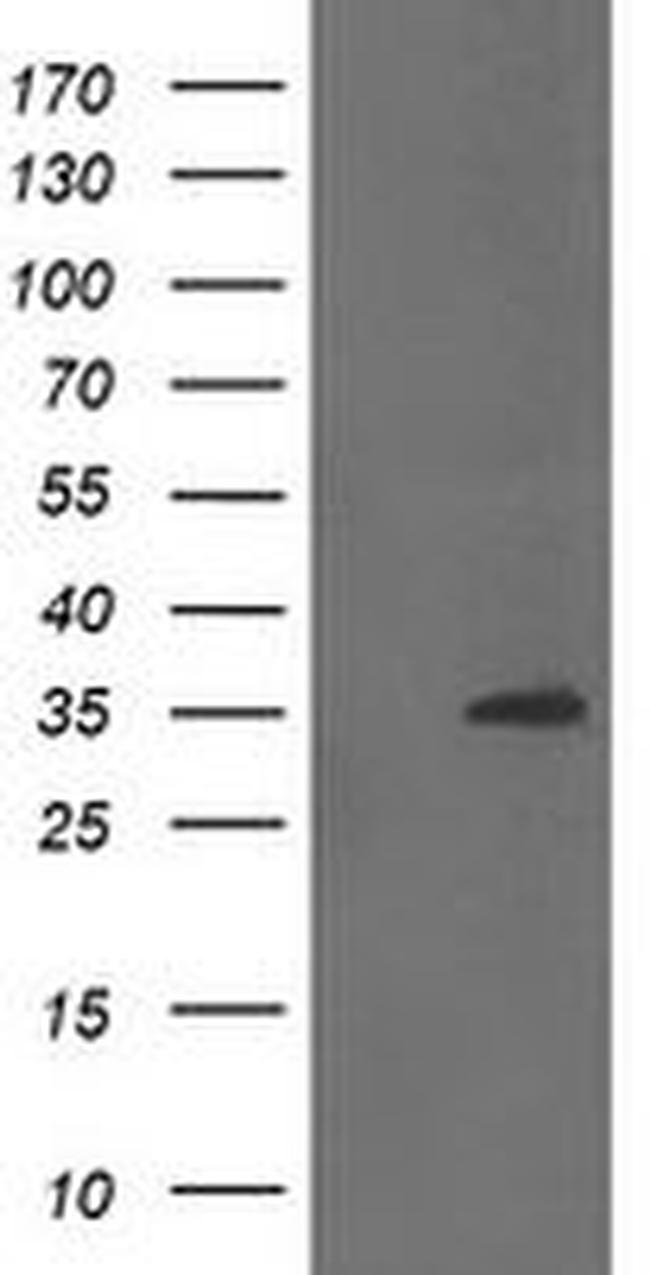 CGI-62 Antibody in Western Blot (WB)