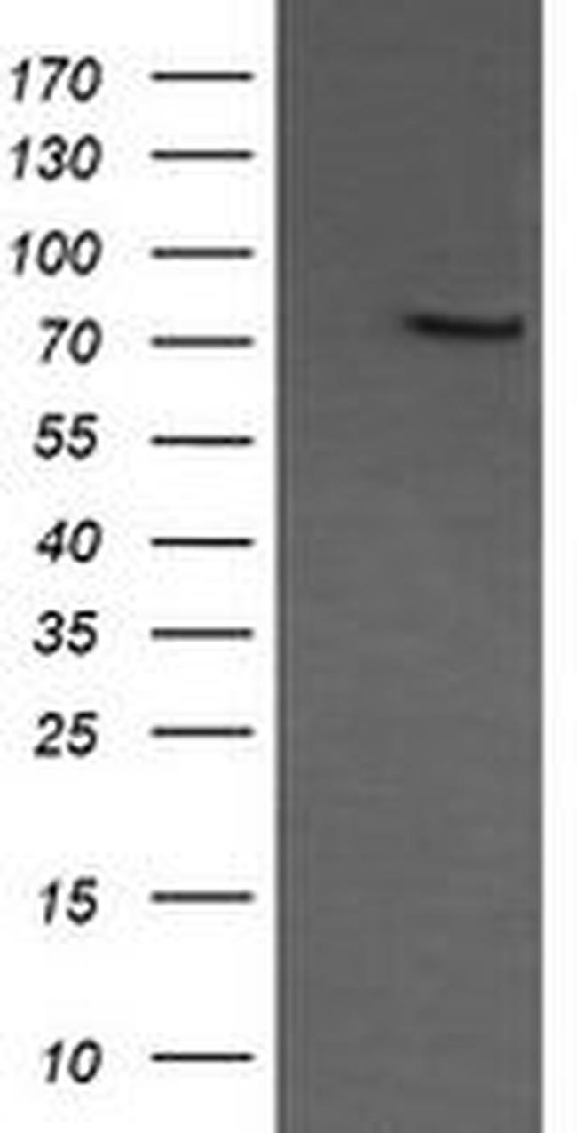 COG6 Antibody in Western Blot (WB)