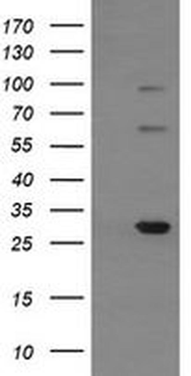 TRIM38 Antibody in Western Blot (WB)
