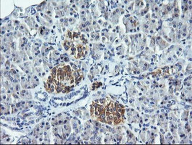 DNM1L Antibody in Immunohistochemistry (Paraffin) (IHC (P))