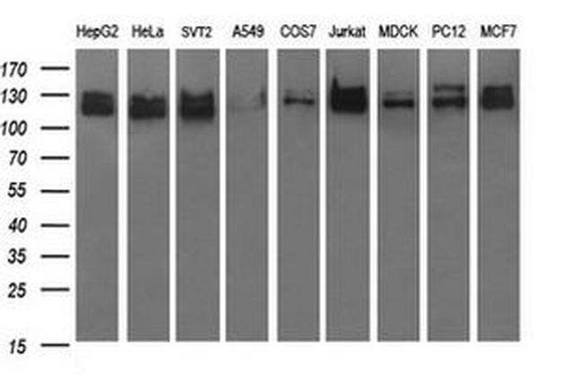 RAPGEF1 Antibody in Western Blot (WB)