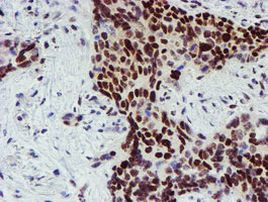 SLUG Antibody in Immunohistochemistry (Paraffin) (IHC (P))