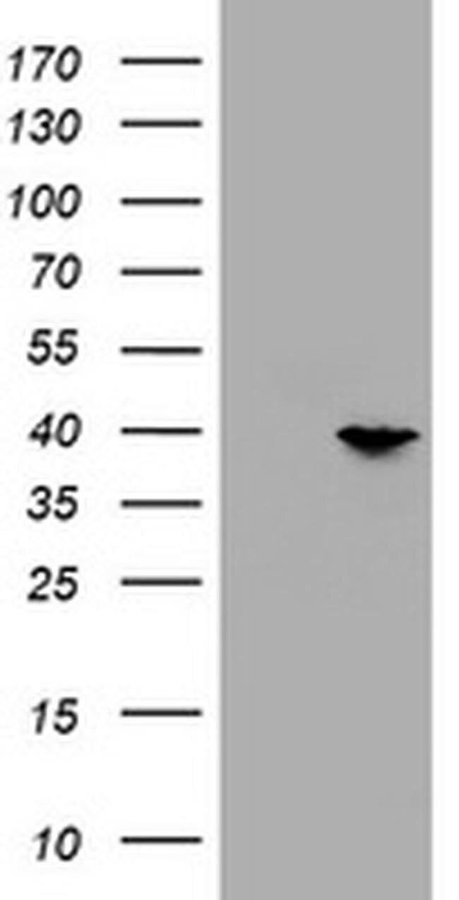 PRR11 Antibody in Western Blot (WB)