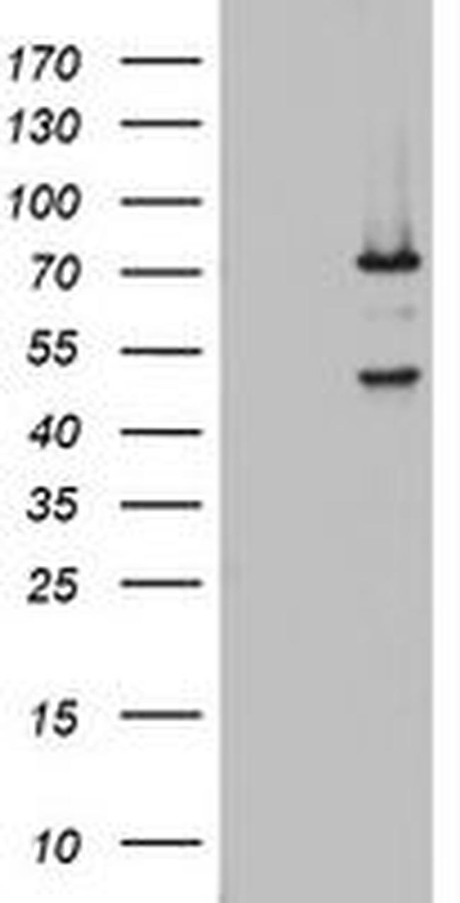 OAS2 Antibody in Western Blot (WB)