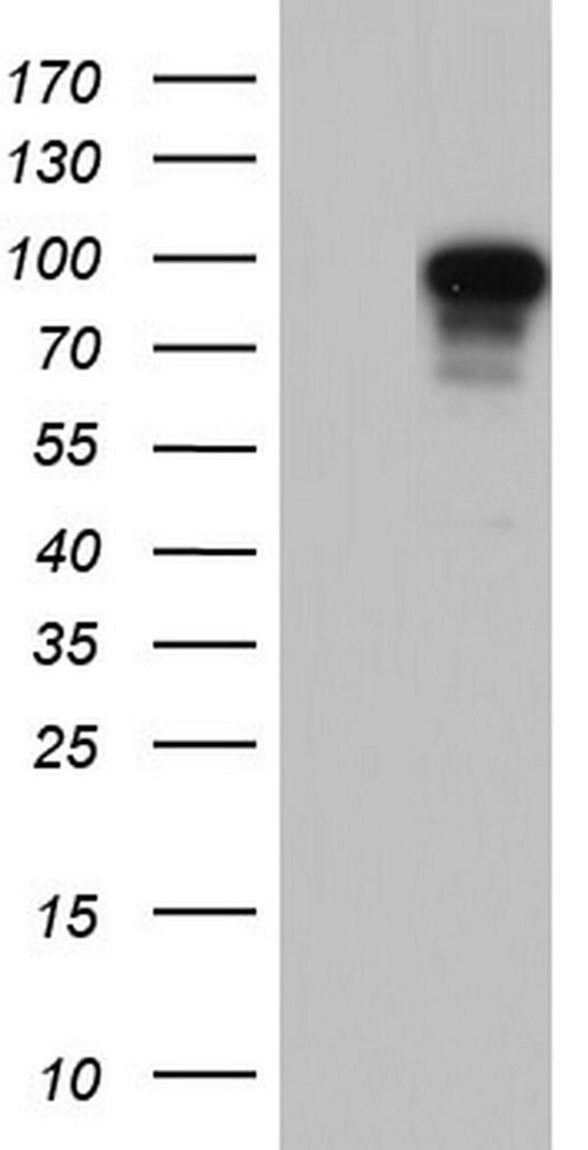 Filensin Antibody in Western Blot (WB)