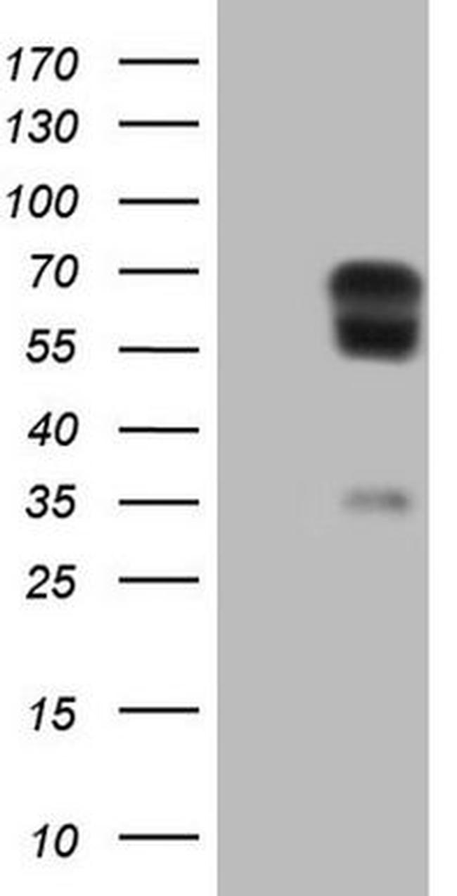 tPA Antibody in Western Blot (WB)
