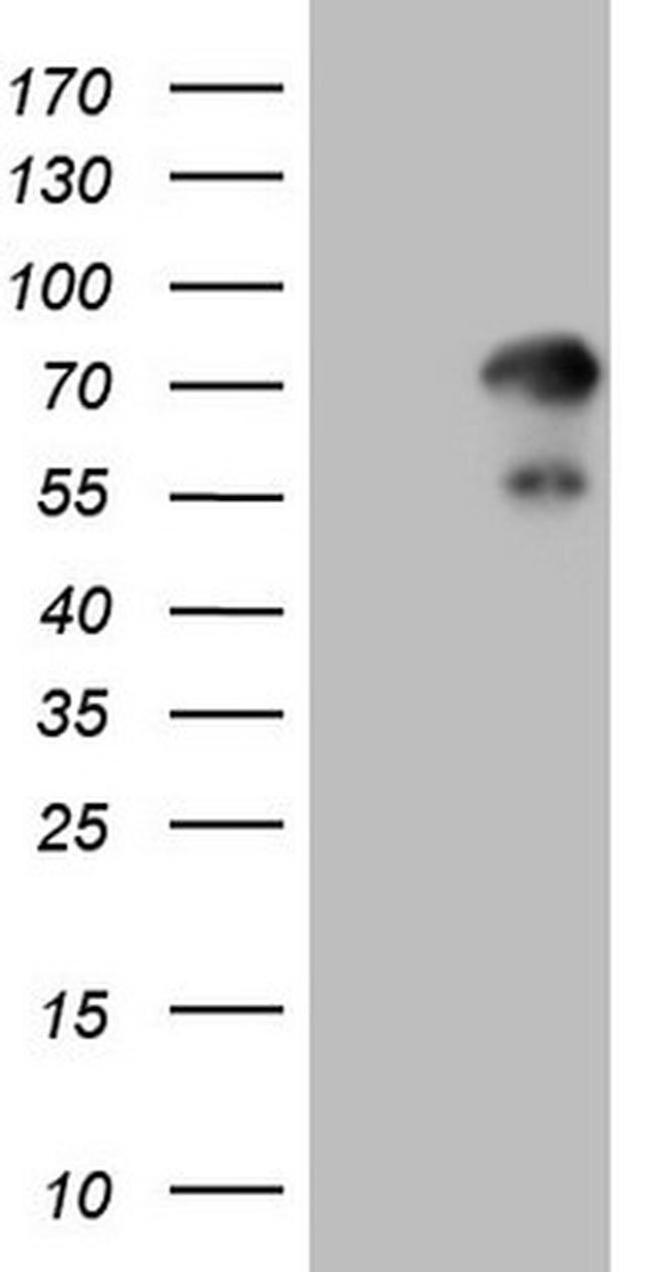 ZNF394 Antibody in Western Blot (WB)
