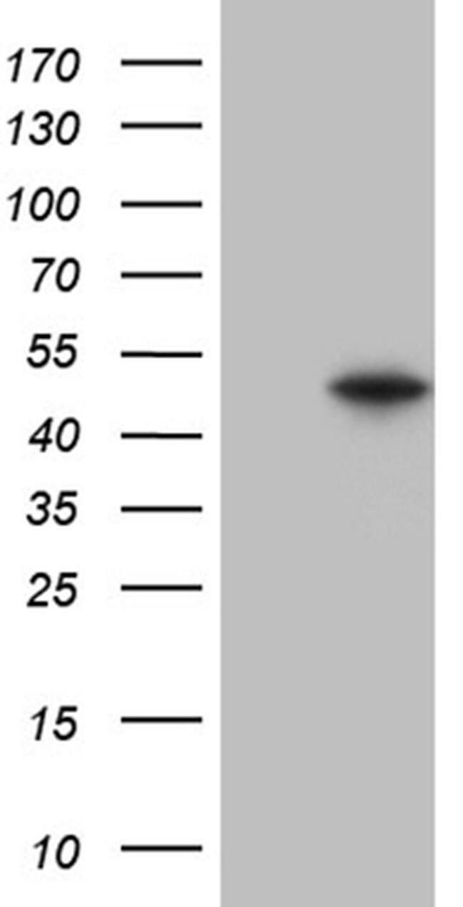 GNAS Antibody in Western Blot (WB)
