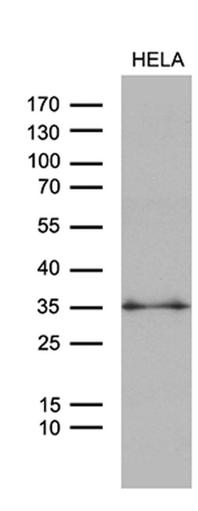 ZMAT4 Antibody in Western Blot (WB)