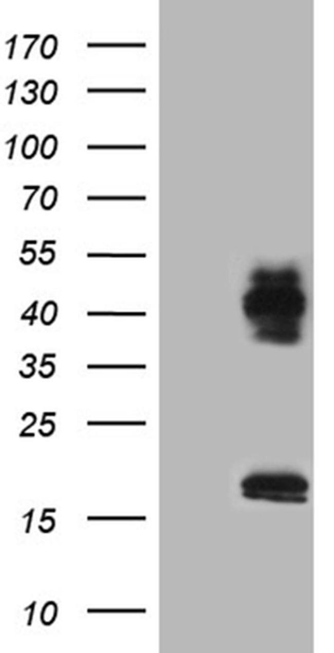 Lass2 Antibody in Western Blot (WB)
