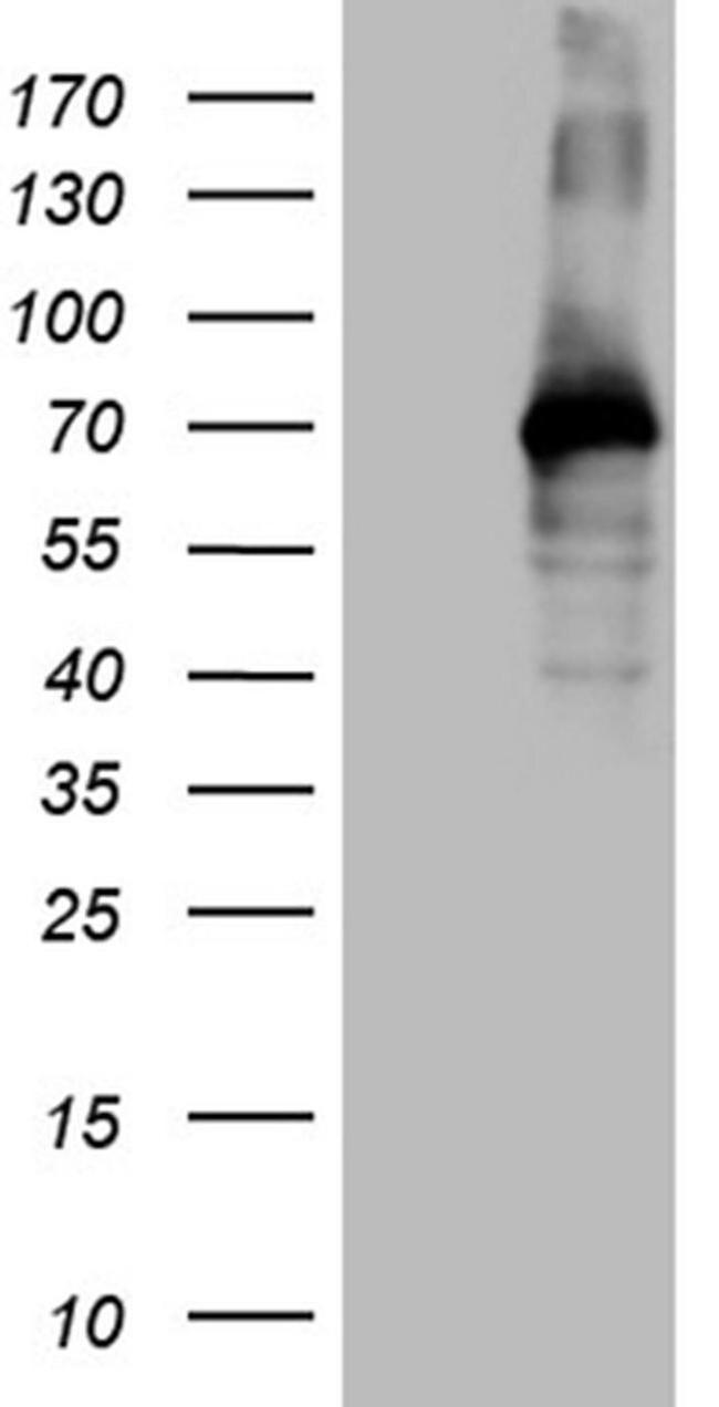 ZFP37 Antibody in Western Blot (WB)