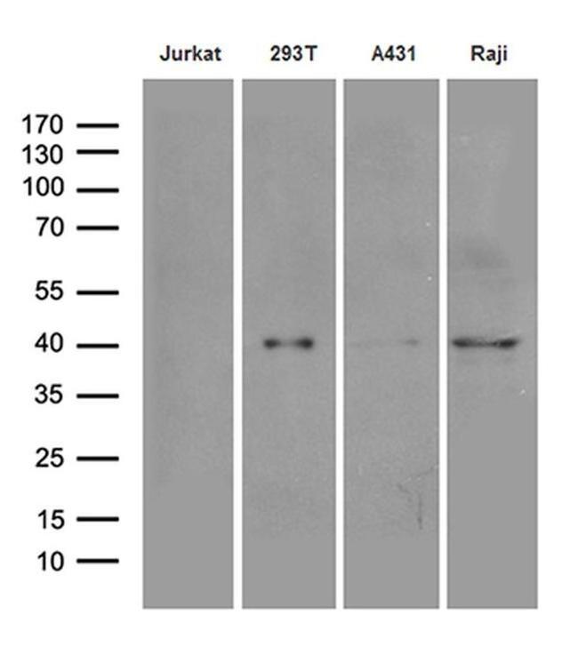 DNAJB5 Antibody in Western Blot (WB)
