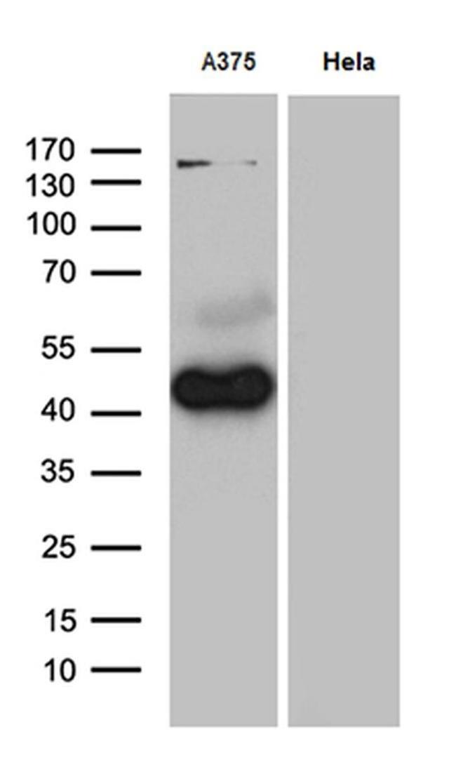 PHLDA1 Antibody in Western Blot (WB)