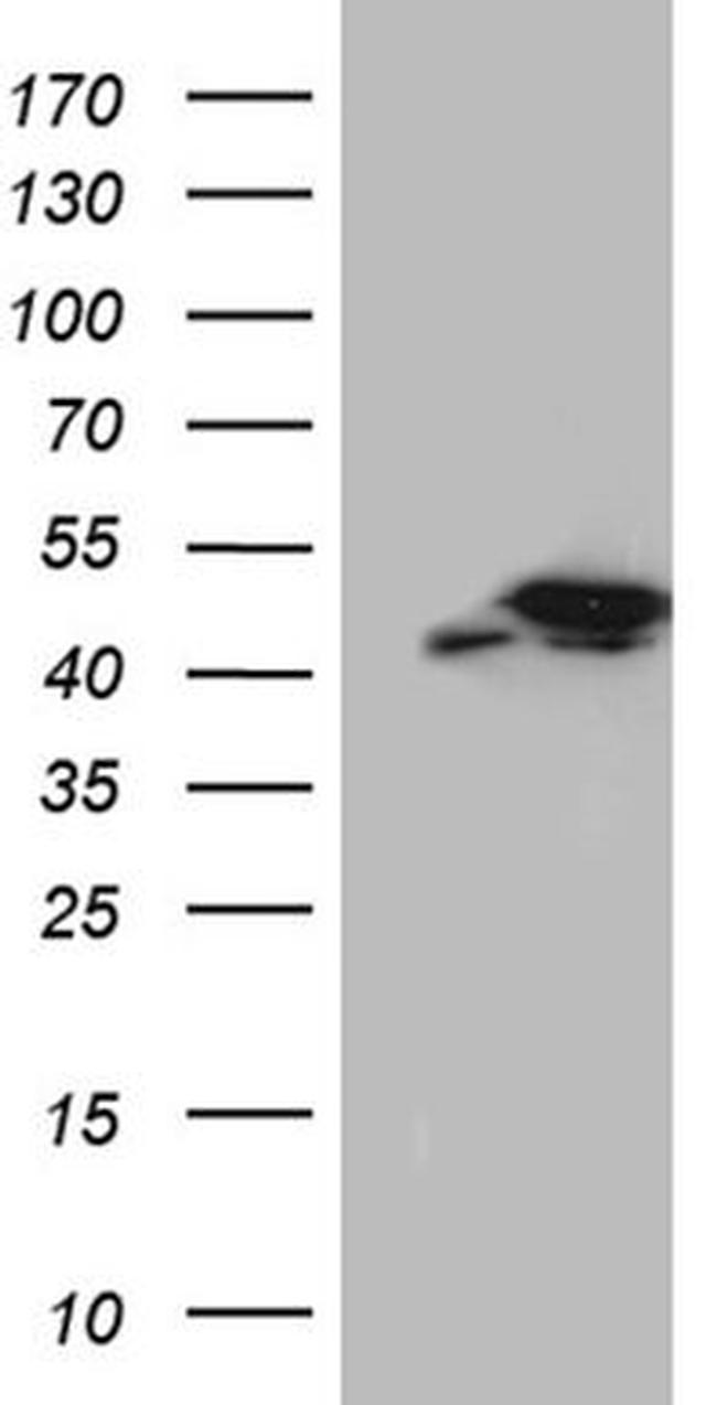 TXNL2 Antibody in Western Blot (WB)