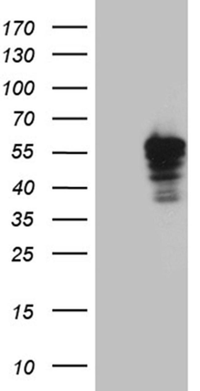 OXPAT Antibody in Western Blot (WB)