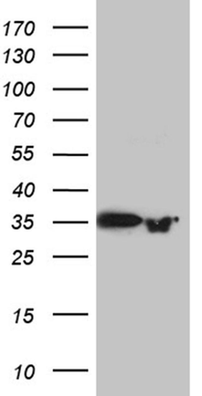 PRPS1L1 Antibody in Western Blot (WB)