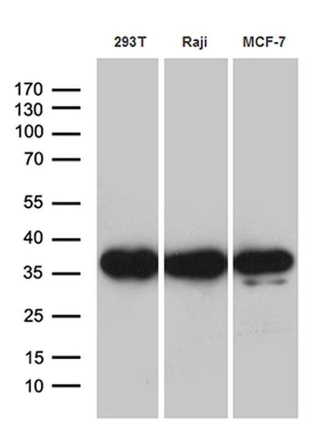 PRPS1L1 Antibody in Western Blot (WB)