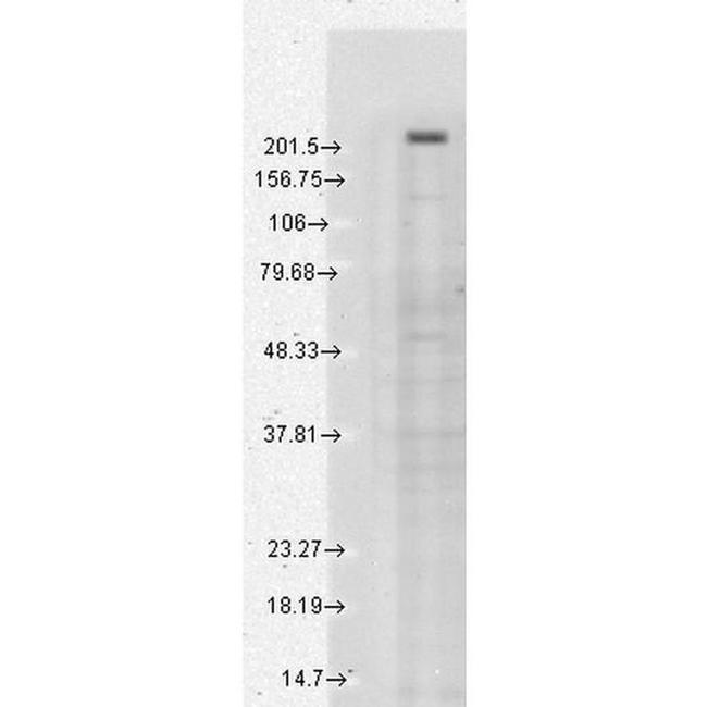TRPM7 Antibody in Western Blot (WB)