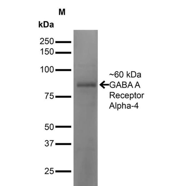GABRA4 Antibody in Western Blot (WB)