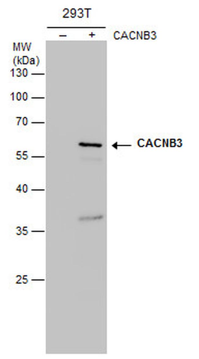 CACNB3 Antibody in Western Blot (WB)