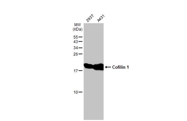 Cofilin Antibody in Western Blot (WB)
