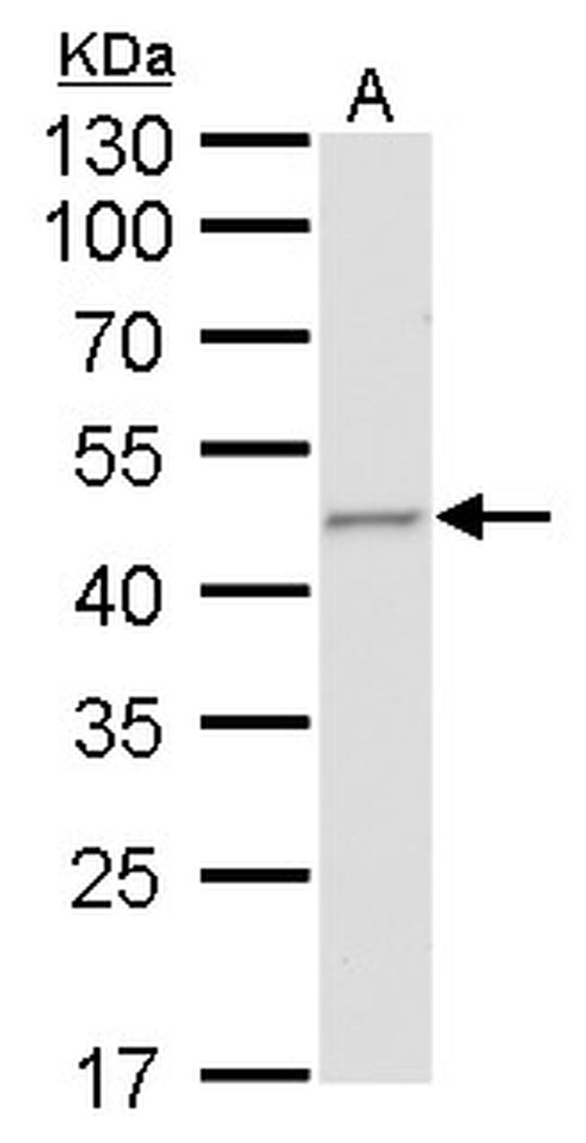 Fumarase Antibody in Western Blot (WB)