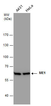 ME1 Antibody in Western Blot (WB)