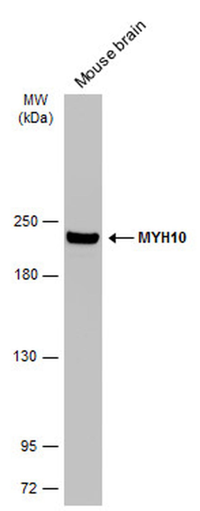 MYH10 Antibody in Western Blot (WB)