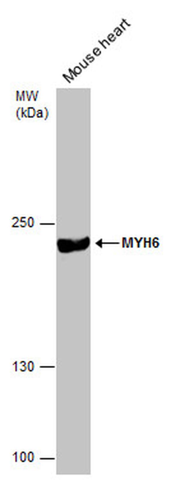 MYH6 Antibody in Western Blot (WB)