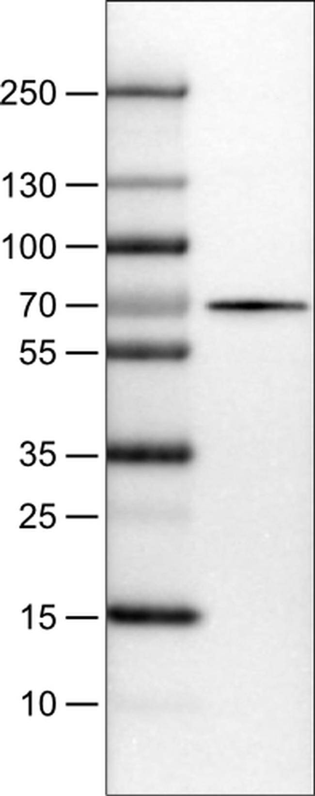 SLC27A5 Antibody in Western Blot (WB)