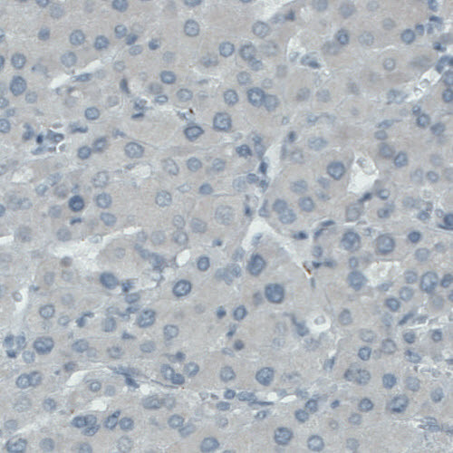 SLC27A5 Antibody in Immunohistochemistry (IHC)