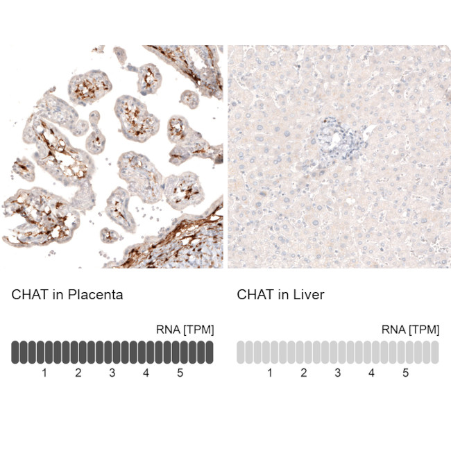 ChAT Antibody in Immunohistochemistry (IHC)