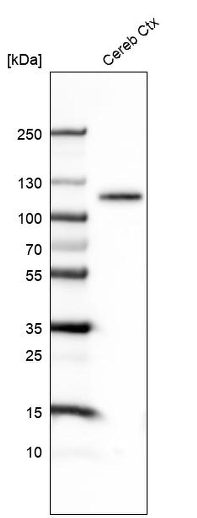 BCL11B Antibody in Western Blot (WB)