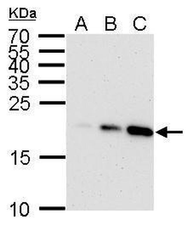 p21 Antibody in Western Blot (WB)