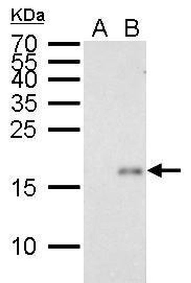 p21 Antibody in Western Blot (WB)