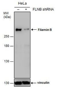 Filamin B Antibody