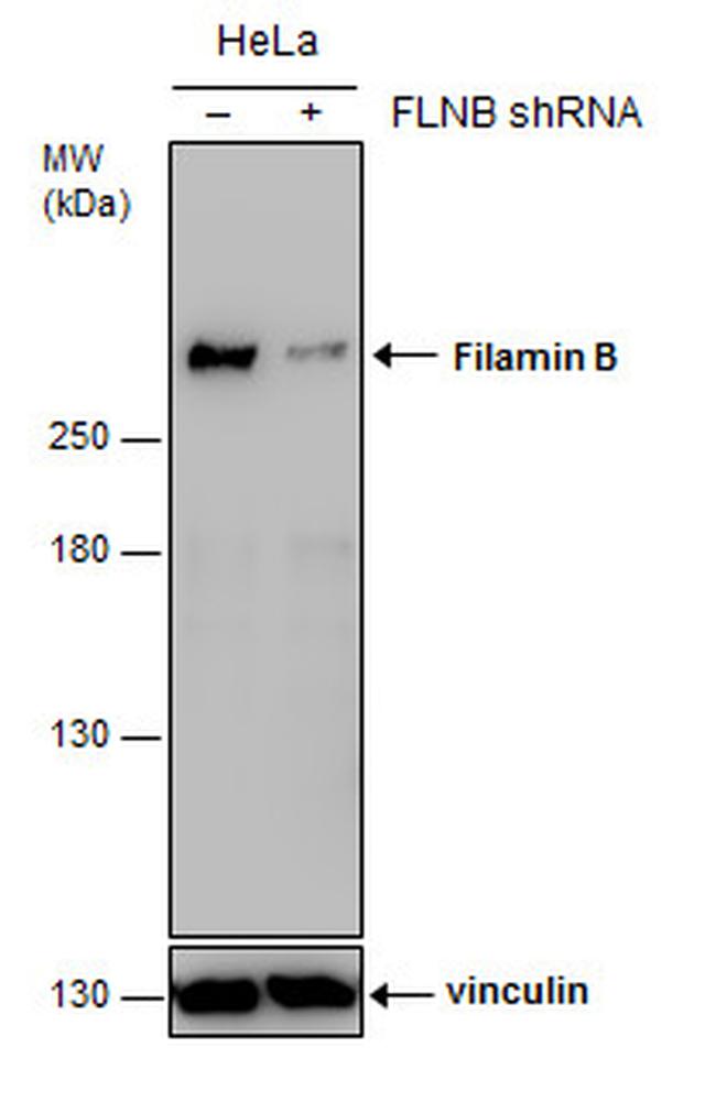 Filamin B Antibody in Western Blot (WB)