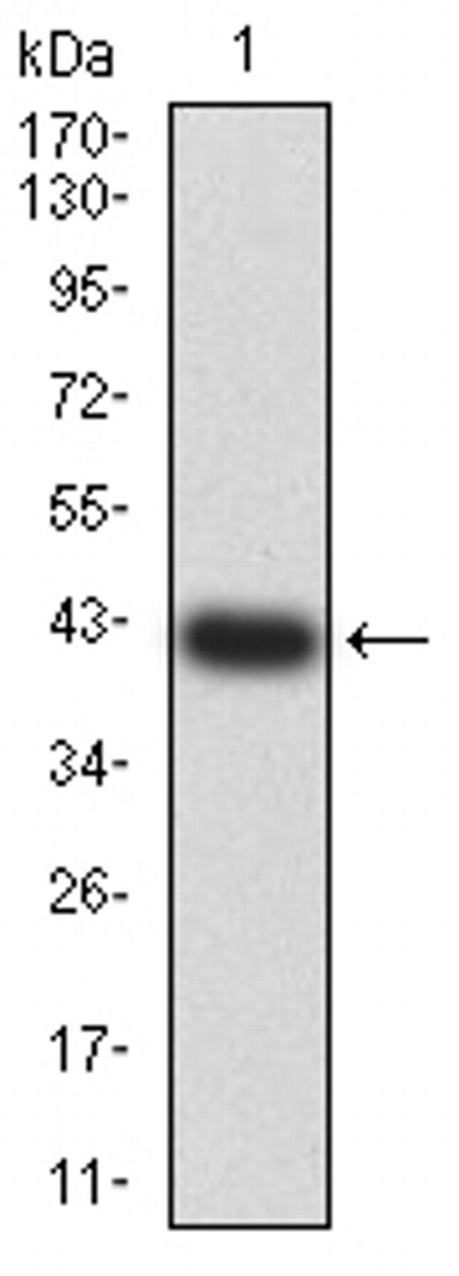 BCL9L Antibody in Western Blot (WB)