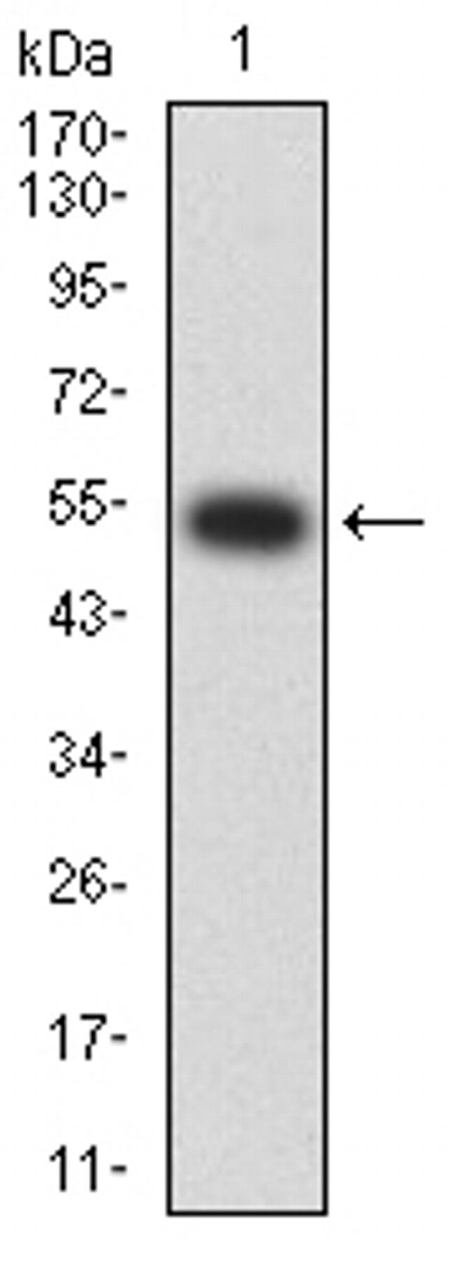 CHRNA2 Antibody in Western Blot (WB)