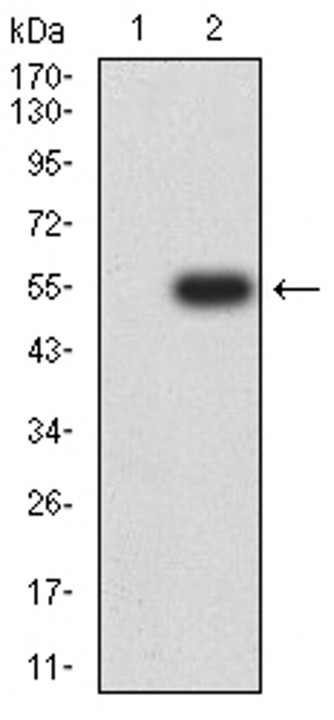 CHRNA3 Antibody in Western Blot (WB)