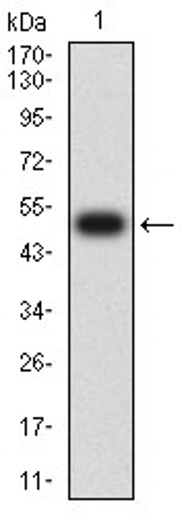 CHRNB4 Antibody in Western Blot (WB)