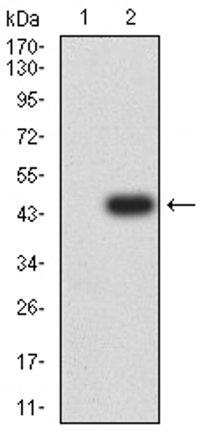 mGluR7 Antibody in Western Blot (WB)
