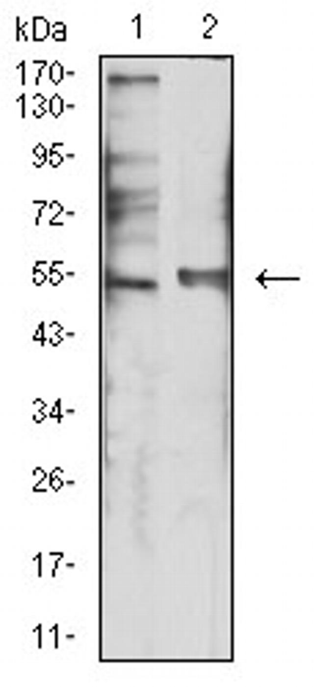 HTR3B Antibody in Western Blot (WB)