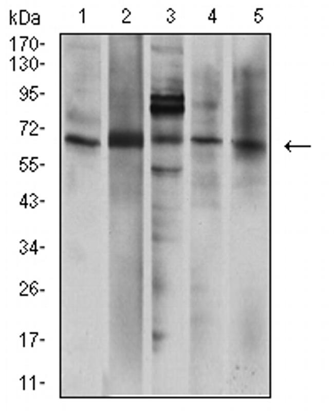P2X7 Antibody in Western Blot (WB)