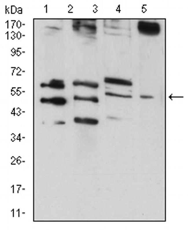 RAD52 Antibody in Western Blot (WB)