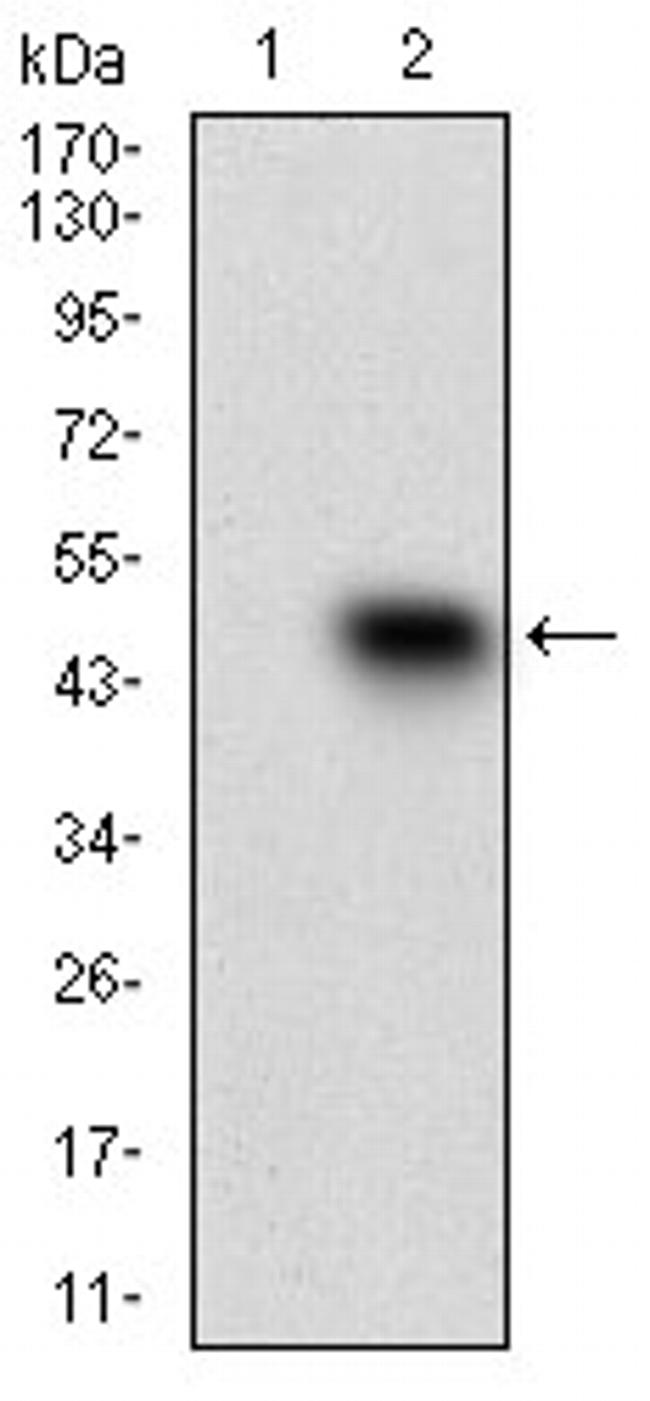 SSTR3 Antibody in Western Blot (WB)