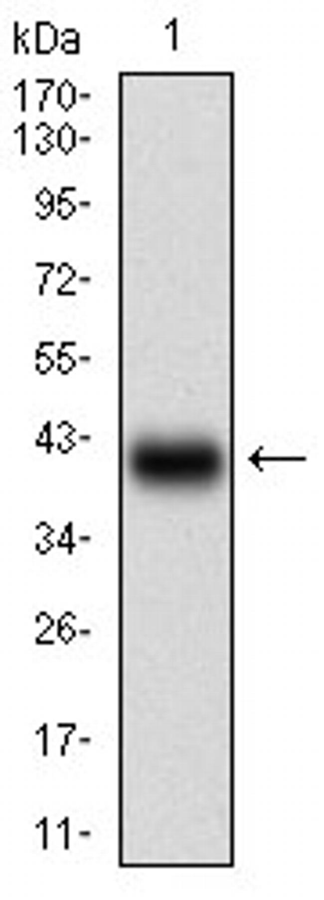 TFF2 Antibody in Western Blot (WB)