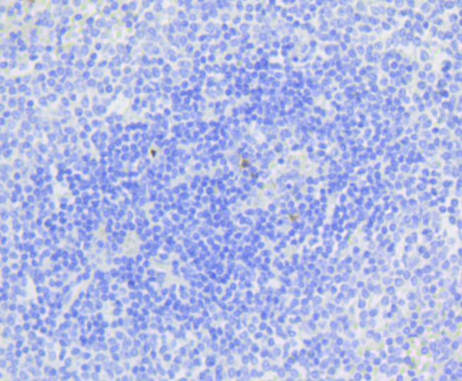 Active Caspase 3 Antibody in Immunohistochemistry (Paraffin) (IHC (P))